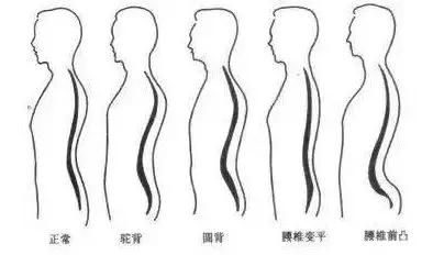 针灸治疗疼痛的偏方,针灸治疗腰疼痛的偏方