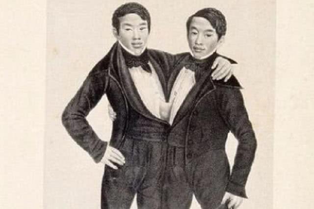 连体兄弟俩娶连体姐妹俩,马戏团连体双胞胎娶妻生子