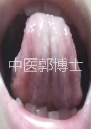 月经迟迟不来补气血用什么中成药,例假淋漓不尽吃黄体酮还出血