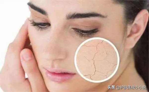 冬天怎么化妆才不干起皮,脸上紧绷干痒起皮像有一层皮
