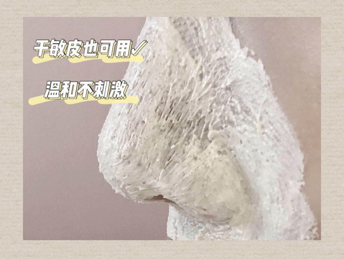 去黑头攻略：被黑头耽误的鼻子是该处理一下了