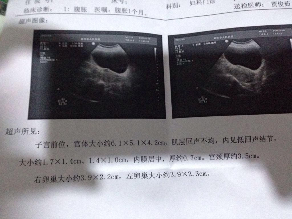 腹主动脉瘤最好的中成药治疗偏方,手术治疗腹主动脉瘤的方法有哪些