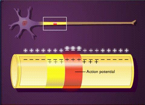 肾炎为什么导致水钠潴留,水钠潴留导致的原因