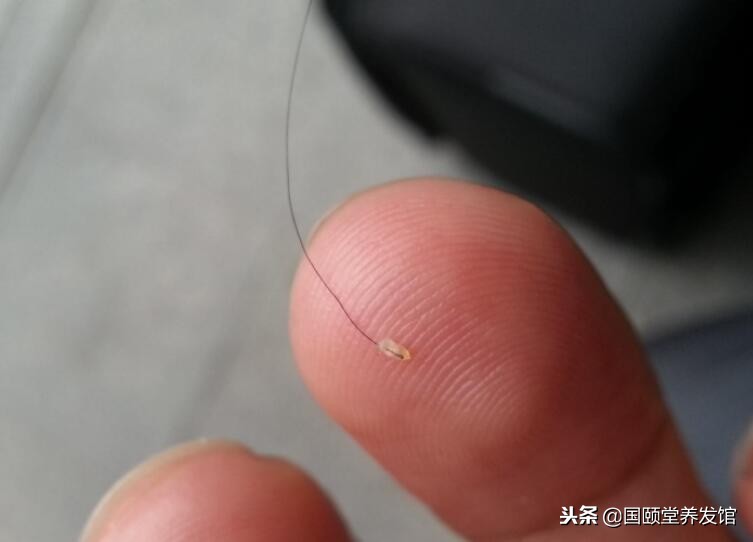 国颐堂养发馆对脱发有效果吗,国颐堂养发馆治白发可靠吗