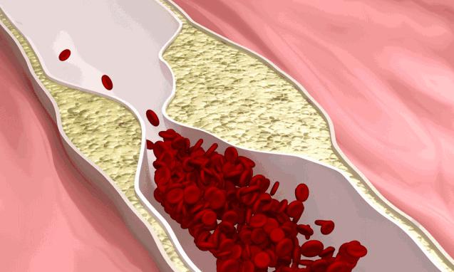咖啡到底是“致癌”还是“治癌”?今天还它清白...