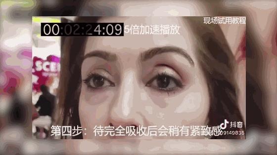 护肤黑科技顶级医美,用黑科技去除眼袋肿了十天