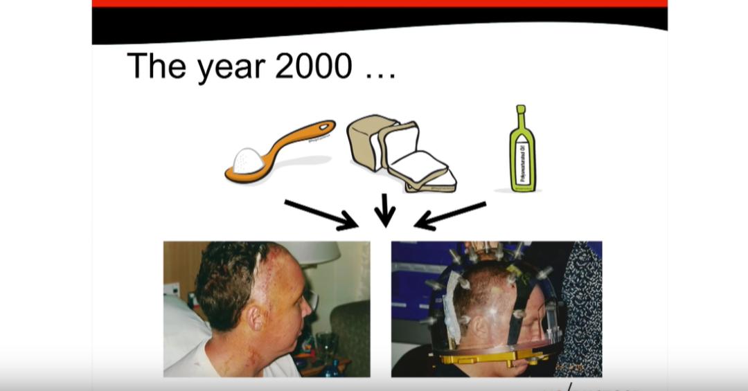 澳洲骨科执业医师，建议患者少吃米面糖，竟然被幕后黑手组织*害迫**