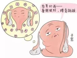 女性的子宫脱垂怎么治疗好,女性平常要怎么注意子宫脱垂
