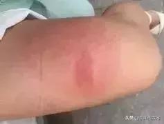 夏天最爱登门拜访惠州人的虫子，满屏全都是惊吓