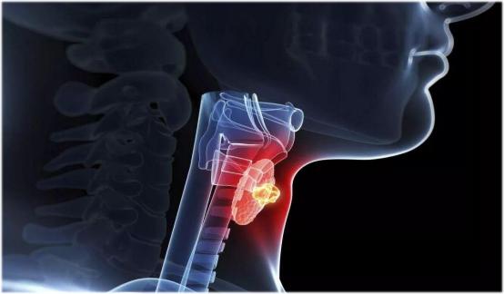 促甲状腺激素能预防乳腺癌吗,三碘甲状腺原氨酸1.71