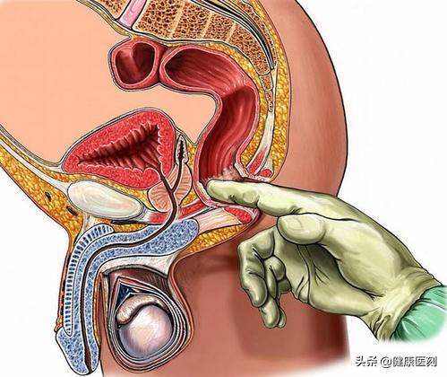 粑粑颜色是深褐色的是什么原因,绿色粑粑是癌症吗