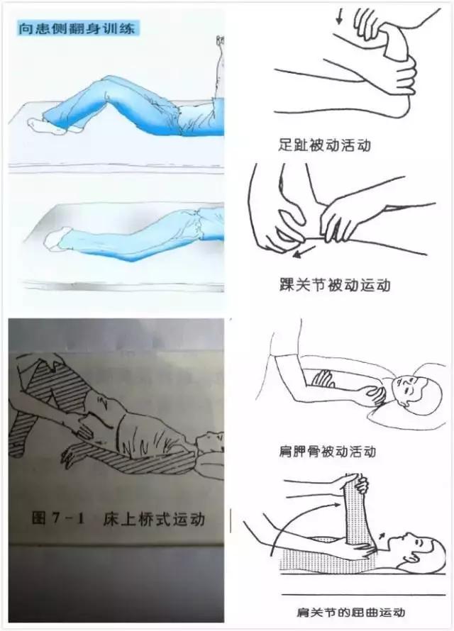 医生详细图文演示：脑卒中患者各阶段康复治疗方案，建议收藏！