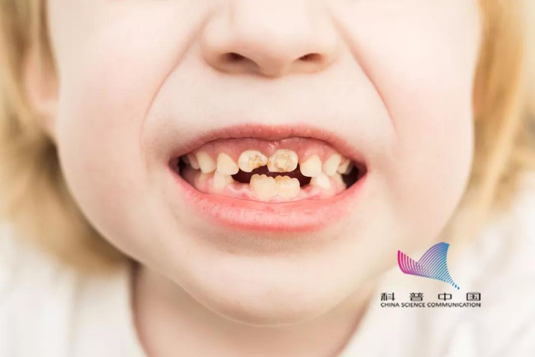 为什么戴口罩总能闻到一股酸味,戴口罩有臭味是口臭吗