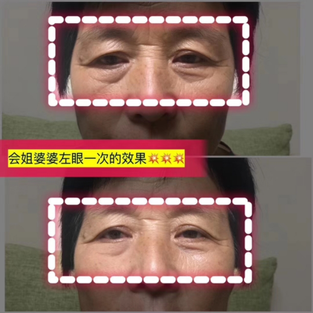 s37微雕眼霜代理,s37微雕眼霜去眼袋