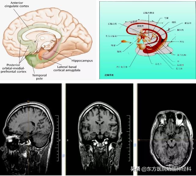 精神病人的前世,精神科药物的前世今生