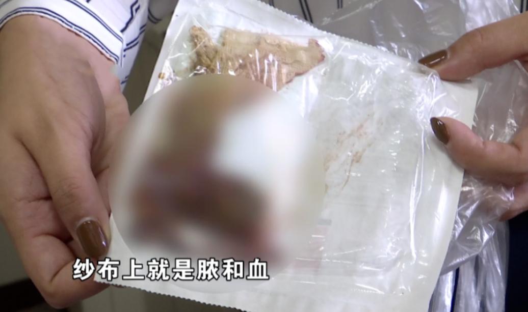 做完肛瘘手术怎么消除疼痛,肛瘘手术后伤口隐隐作痛