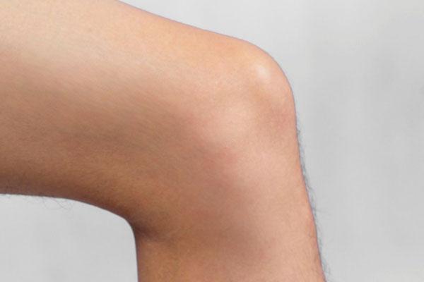 过度肥胖正常吃六成饱能减肥吗,过度肥胖如何减肥