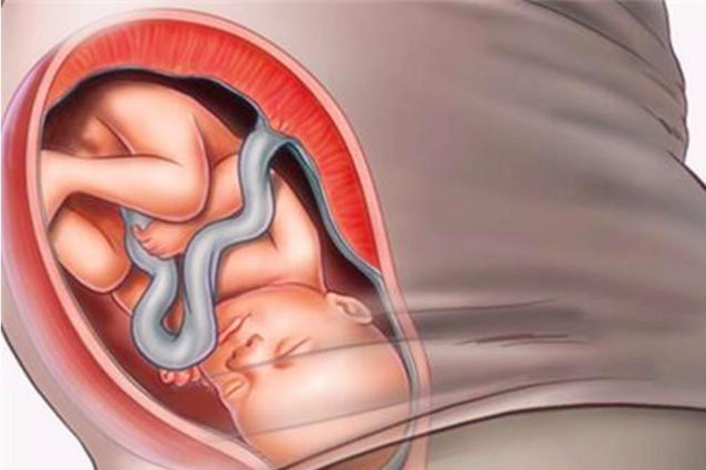 胎儿猛涨期需要的营养,胎儿进入猛涨期会不会胎动减少