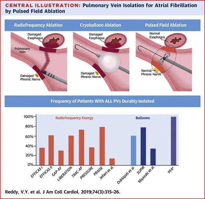 心脏电生理临床指南,心脏电生理检查可以查出哪些问题