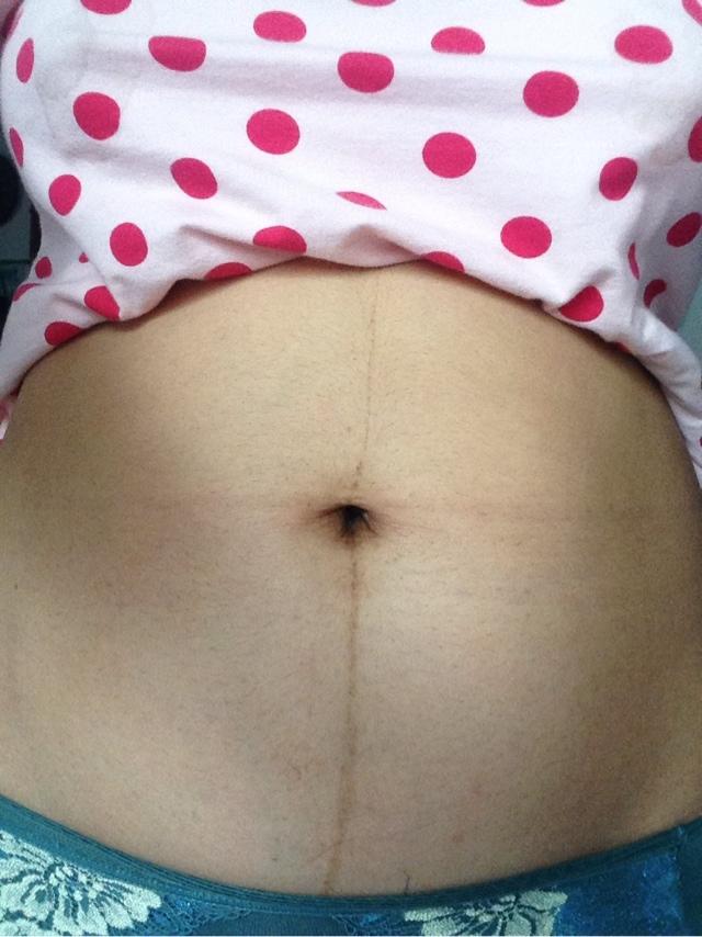 别人生完看不出,自己生完回不去,“产后易瘦体质”有哪些特征?