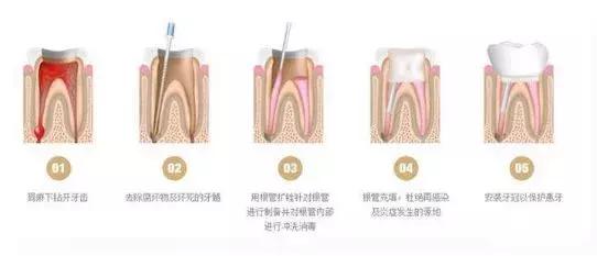 口腔治疗费用明细清单,昆明口腔治疗费用