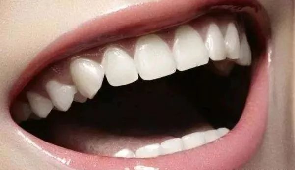 刷牙怎么掉一块牙结石,刷牙如何刷掉牙垢和脏东西