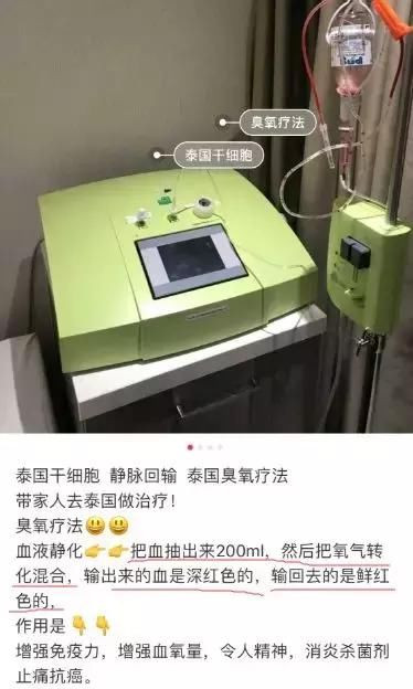 花三万换血15次,一周两次换血净化血液垃圾