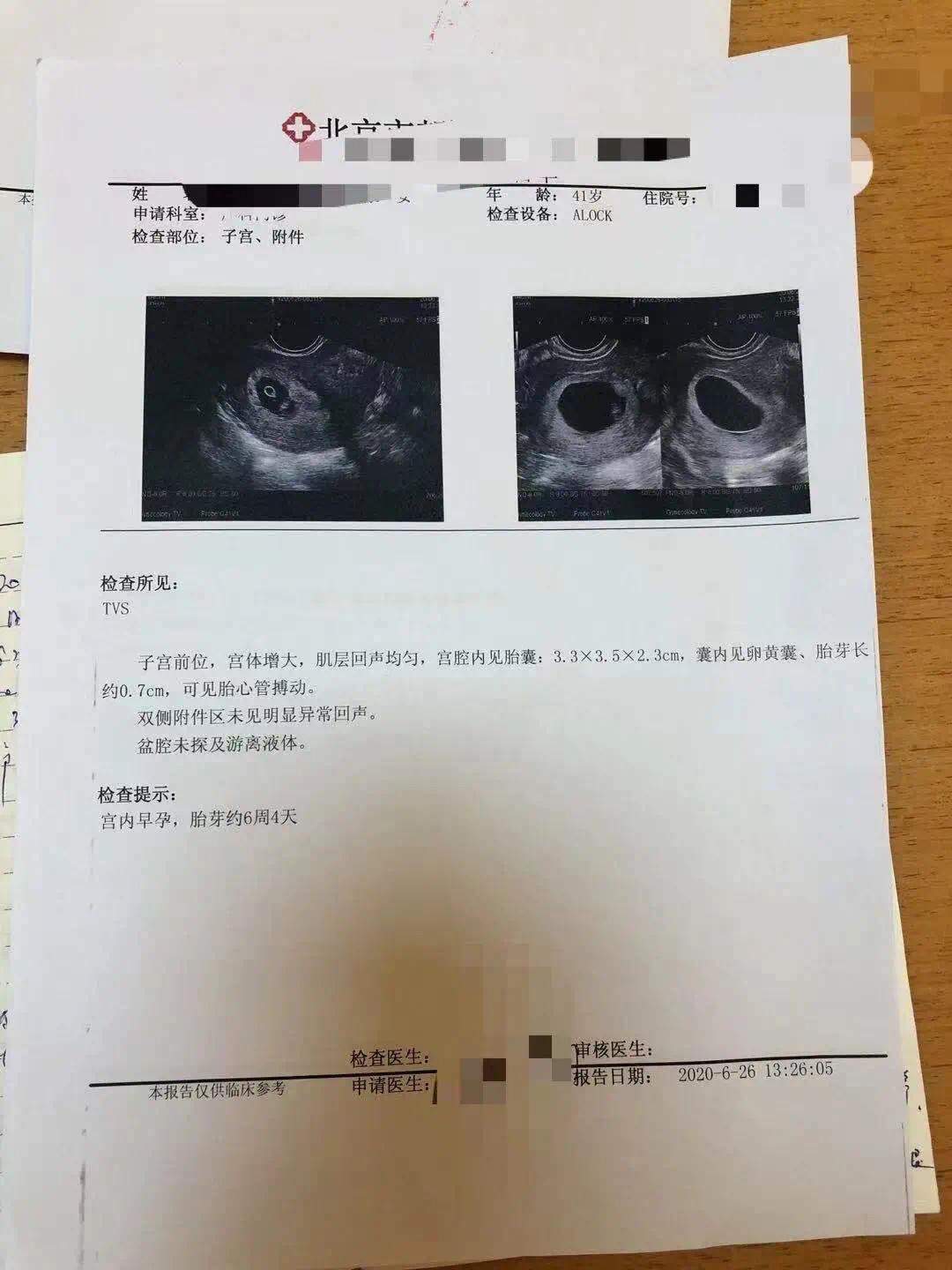 多次生化妊娠成功案例,人流后连续两次生化妊娠