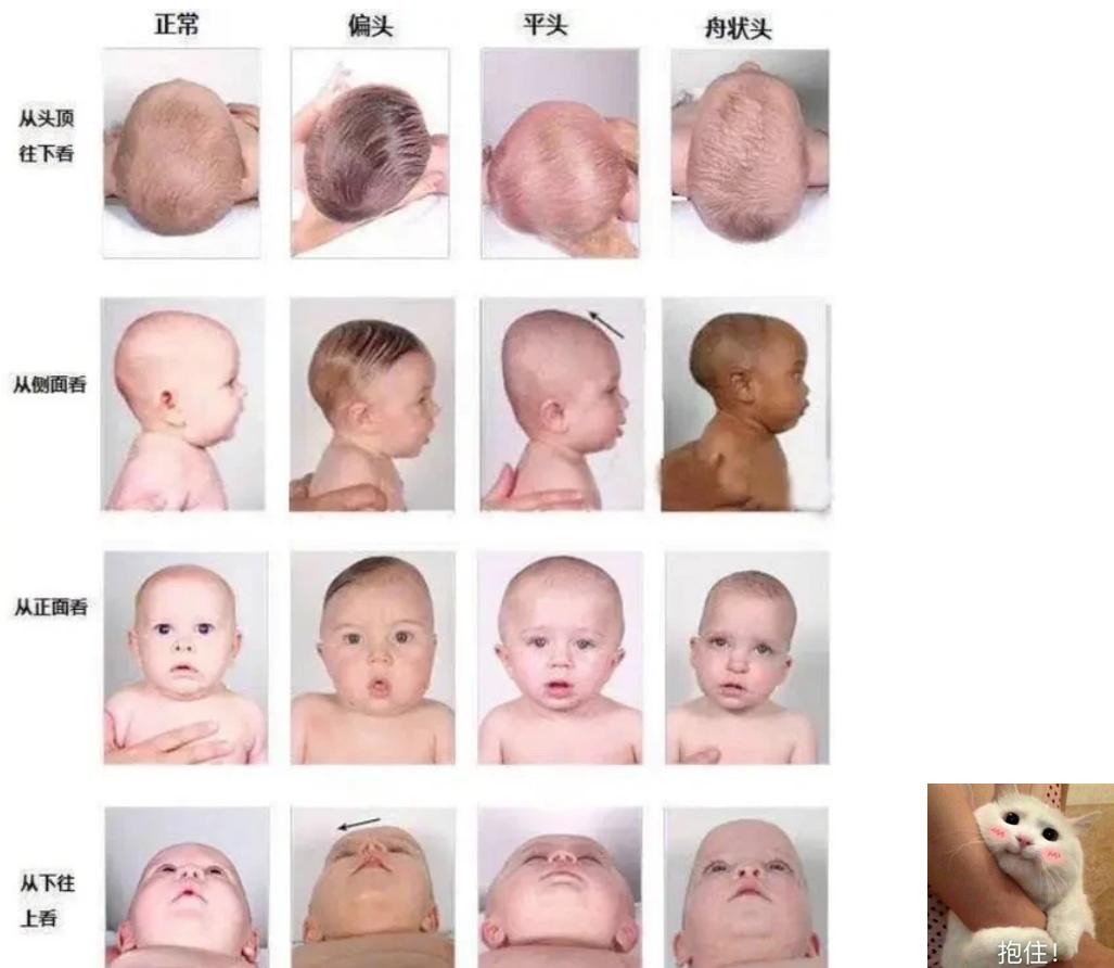 为什么宝宝脸都像蜡笔小新,为什么宝宝脸像包子