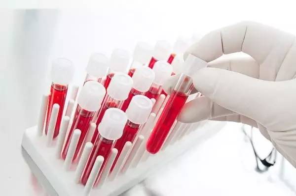 血脂检查中的低密度脂蛋白是什么,低密度脂蛋白高多长时间检测血脂