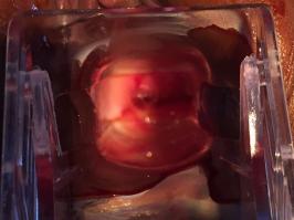 外阴最好多久冲洗一次,外阴多久进行一次冲洗好