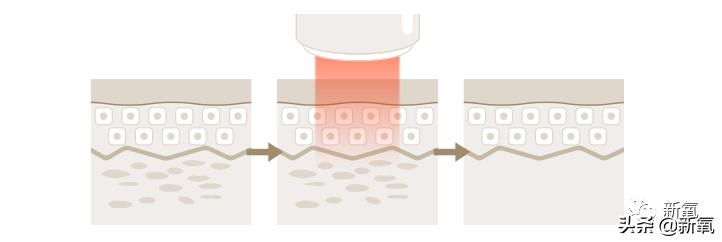 宋祖儿雀斑造型美到窒息,宋祖儿脸上的雀斑一清二楚