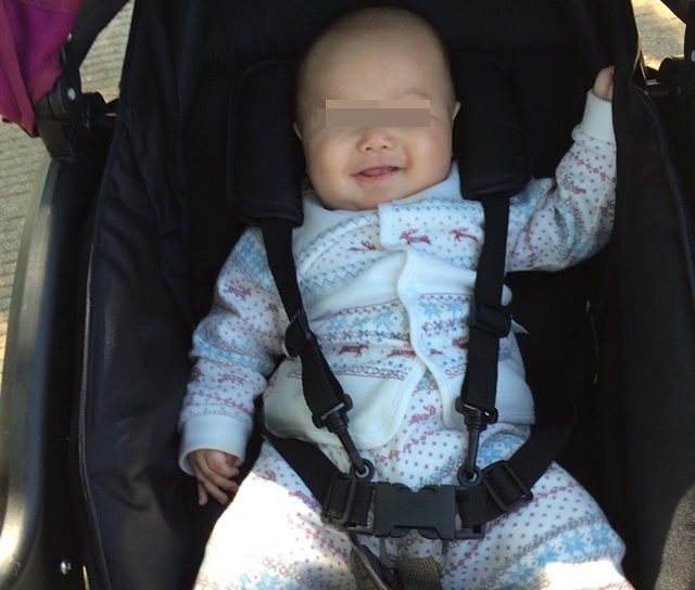 四个月婴儿脊柱变形怎么治疗,5个月宝宝脊柱发育错误