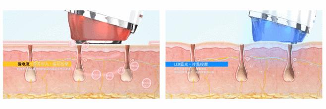 赵露思推荐好物清洁面部,赵露思推荐脸部小熨斗
