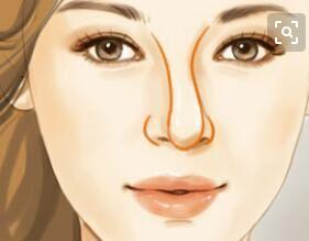 余文林鼻子矫正,余文林裂鼻整形手术