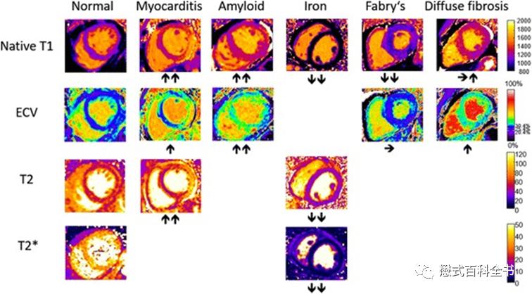 心脏磁共振定位方法,心脏磁共振各参数分析
