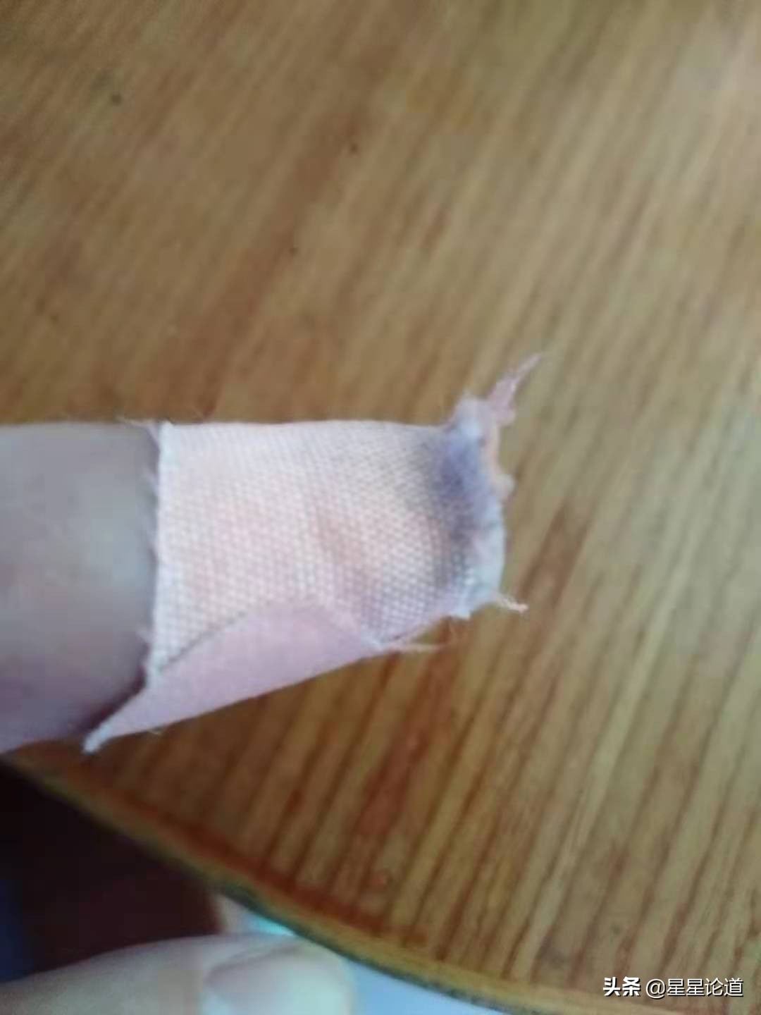 指甲盖划伤修复,指甲盖剪破了怎么办