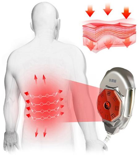 铁腰板治疗仪有效吗多少钱一台,什么地方出售铁腰板治疗仪
