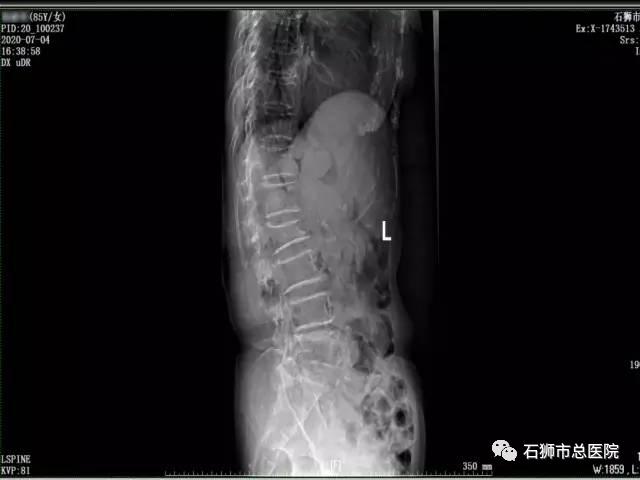 石狮市骨科医院,石狮市总医院骨科多少钱