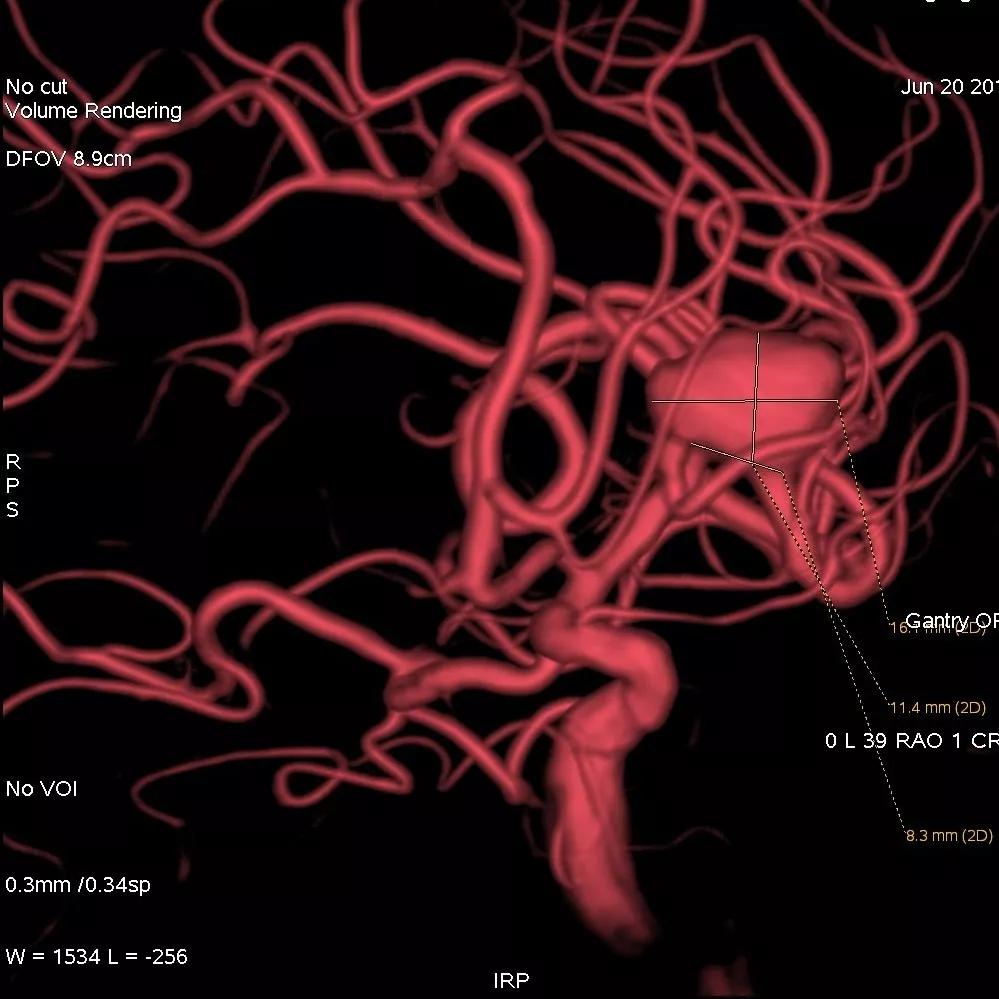 山西省人民医院任少华教授,山西省人民医院任少华