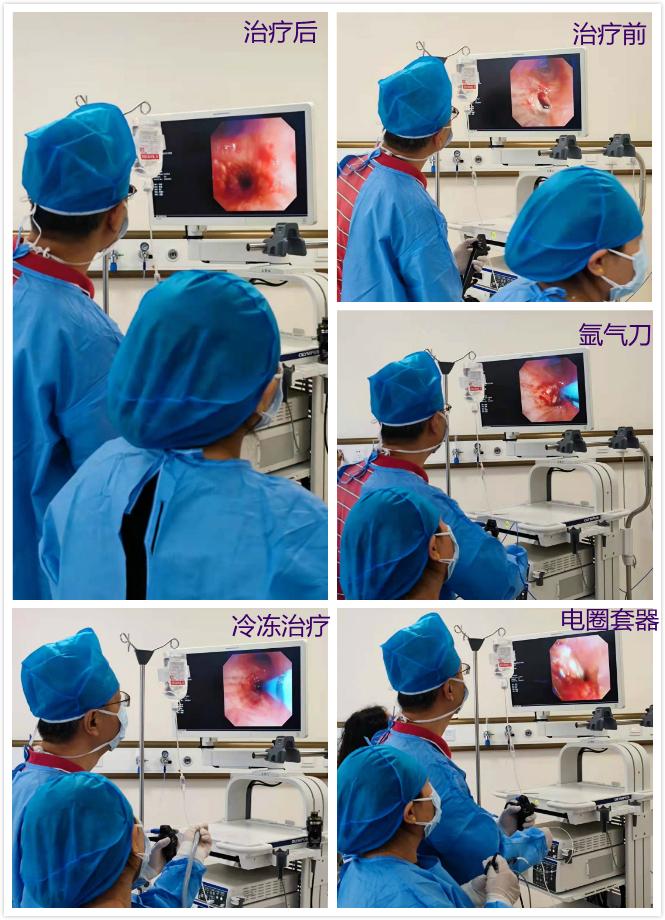 精准微创介入,呼吸介入操作有哪些