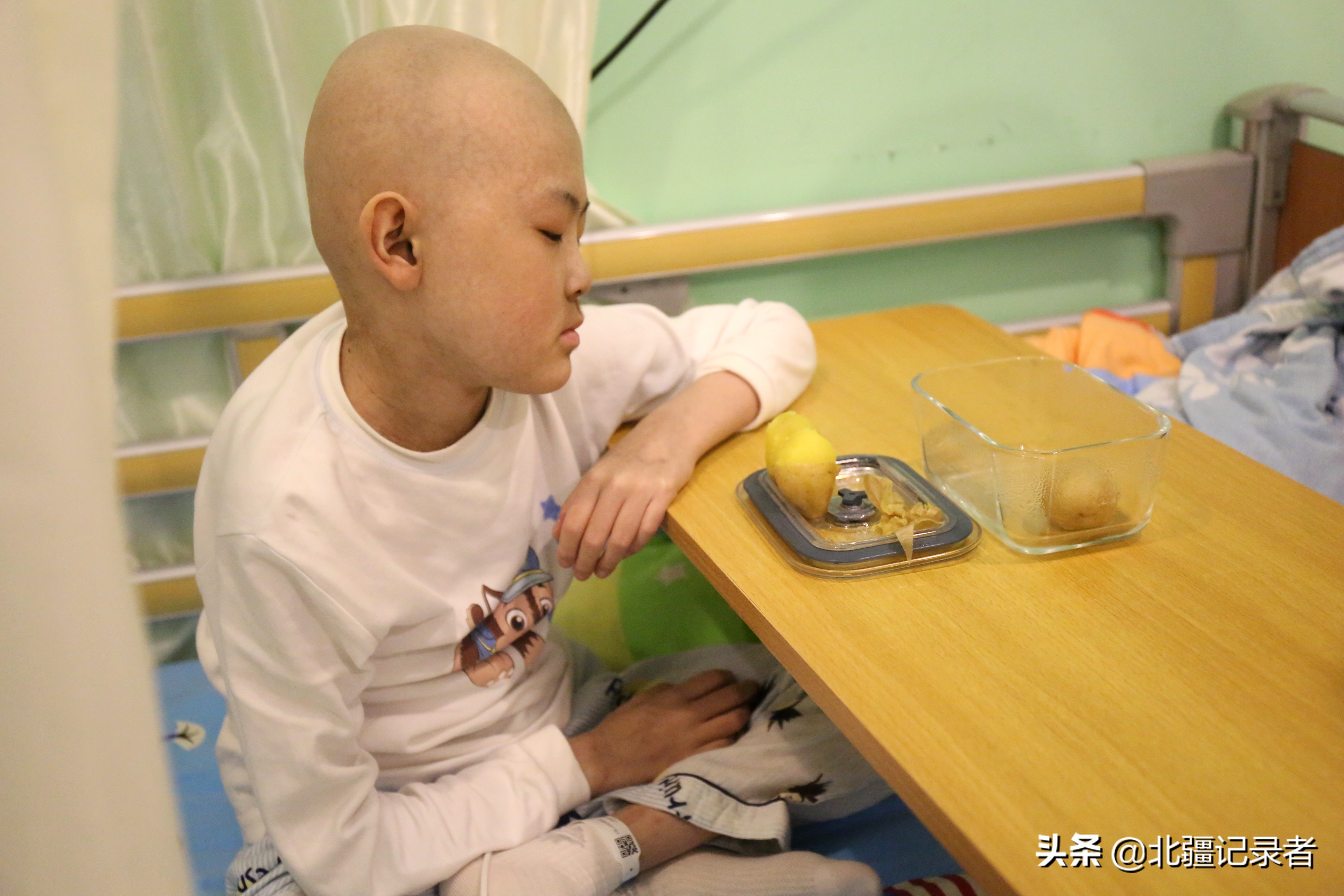 身患重病让儿子捐骨髓,老三孩子生病让大伯捐骨髓