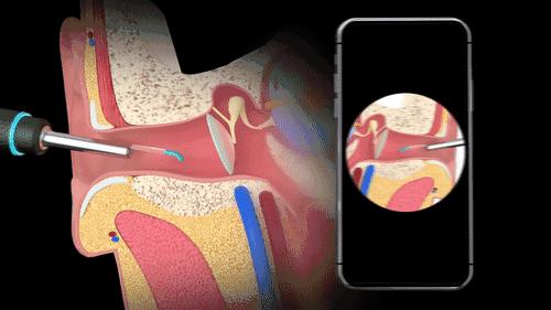 小米采耳,小米联合