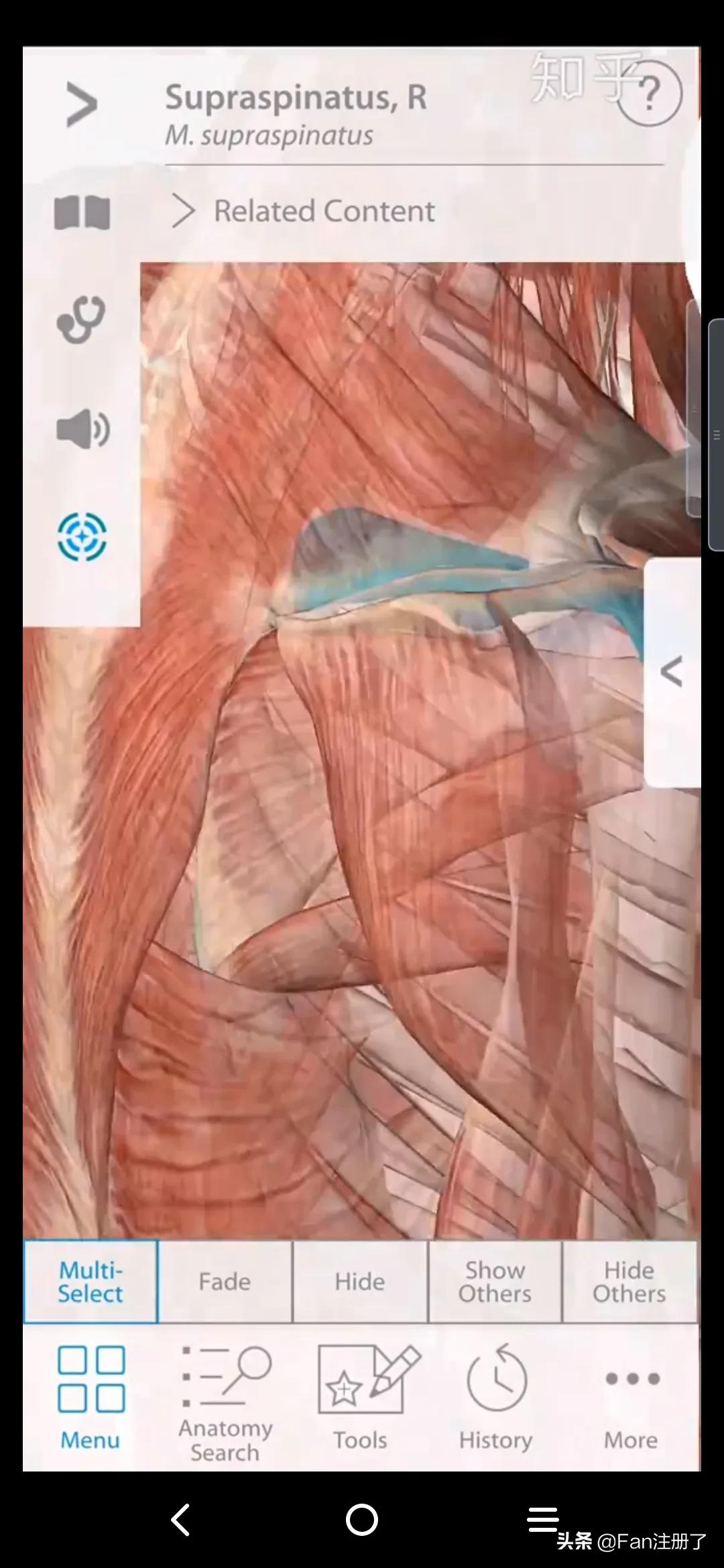 肩痛肩袖损伤针刀治疗,肩痛肩关节活动受限用什么药