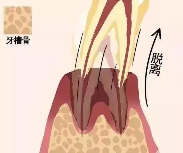 牙齿松动，难以避免的中年危机？慌了