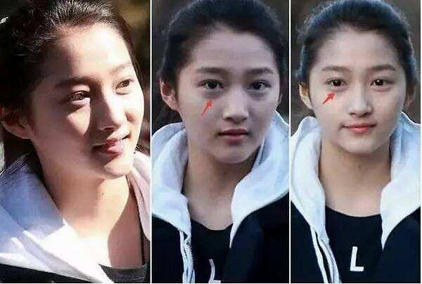 眼袋和卧蚕的区别教你区分小妙招,眼袋和卧蚕的区别在哪里