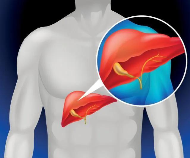 乙肝胆红素高需要抗病毒治疗吗,乙肝胆红素高需要吃保肝降酶药吗