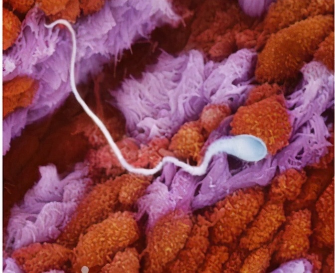 生命萌芽，就充满争斗攻击伤痛：你的出生，已经PK赢了千军万马