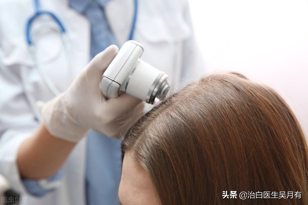 白癜风不治疗有什么影响,白癜风在治疗中容易走进哪些误区