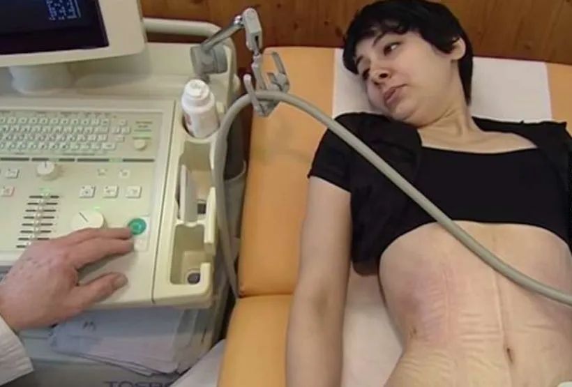 女性漏尿穿束腰裤管用吗,穿束腰导致漏尿怎么办